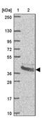 Branched Chain Amino Acid Transaminase 2 antibody, PA5-62914, Invitrogen Antibodies, Western Blot image 