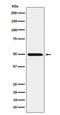Homogentisate 1,2-Dioxygenase antibody, M01909, Boster Biological Technology, Western Blot image 