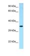 DM1 Locus, WD Repeat Containing antibody, orb326445, Biorbyt, Western Blot image 