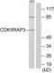CDK5 Regulatory Subunit Associated Protein 3 antibody, LS-B10010, Lifespan Biosciences, Western Blot image 