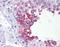 ADP-Ribosyltransferase 3 antibody, orb89557, Biorbyt, Immunohistochemistry paraffin image 
