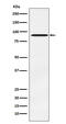 ATR Interacting Protein antibody, M03862-1, Boster Biological Technology, Western Blot image 