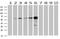 Epoxide Hydrolase 2 antibody, MA5-25223, Invitrogen Antibodies, Western Blot image 