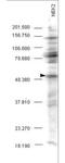 NIMA Related Kinase 2 antibody, NBP1-78022, Novus Biologicals, Western Blot image 