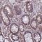 Ring Finger Protein 215 antibody, HPA029427, Atlas Antibodies, Immunohistochemistry paraffin image 