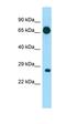 Eukaryotic translation initiation factor 4E type 1B antibody, orb326614, Biorbyt, Western Blot image 