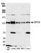 Centrosomal protein CP110 antibody, A301-343A, Bethyl Labs, Western Blot image 