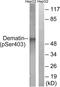 Dematin Actin Binding Protein antibody, LS-C198878, Lifespan Biosciences, Western Blot image 
