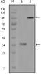 HCK Proto-Oncogene, Src Family Tyrosine Kinase antibody, NBP1-47514, Novus Biologicals, Western Blot image 