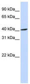 F-Box Protein 28 antibody, TA333839, Origene, Western Blot image 