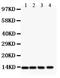 Platelet Derived Growth Factor Subunit B antibody, PB9311, Boster Biological Technology, Western Blot image 