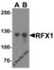 Regulatory Factor X1 antibody, 8199, ProSci, Western Blot image 