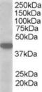 Monocarboxylate transporter 2 antibody, EB05131, Everest Biotech, Western Blot image 
