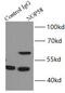 NOP58 Ribonucleoprotein antibody, FNab05796, FineTest, Immunoprecipitation image 