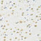 Methylthioadenosine Phosphorylase antibody, LS-C331222, Lifespan Biosciences, Immunohistochemistry frozen image 