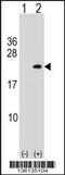 Phospholipase A2 Group XIIA antibody, 58-615, ProSci, Western Blot image 