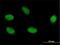 Zinc phosphodiesterase ELAC protein 2 antibody, H00060528-M01, Novus Biologicals, Immunofluorescence image 