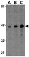 MHC Class I Polypeptide-Related Sequence A antibody, GTX16991, GeneTex, Western Blot image 