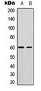 Akt antibody, orb235003, Biorbyt, Western Blot image 