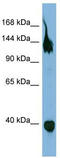 Semaphorin-6A antibody, TA338441, Origene, Western Blot image 