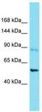 TRPM8 Channel Associated Factor 1 antibody, TA335880, Origene, Western Blot image 