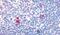 Cannabinoid Receptor 2 antibody, PA5-33443, Invitrogen Antibodies, Immunohistochemistry paraffin image 