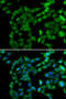 Protein Kinase AMP-Activated Non-Catalytic Subunit Beta 2 antibody, 14-931, ProSci, Immunofluorescence image 