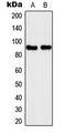 Solute Carrier Family 4 Member 1 Adaptor Protein antibody, LS-C354153, Lifespan Biosciences, Western Blot image 