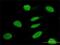 Tripartite Motif Containing 63 antibody, H00084676-M01, Novus Biologicals, Immunocytochemistry image 