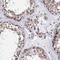 Coiled-Coil Domain Containing 77 antibody, NBP1-93521, Novus Biologicals, Immunohistochemistry frozen image 