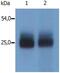 Linker For Activation Of T Cells Family Member 2 antibody, GTX00531, GeneTex, Western Blot image 