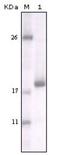 Discoidin Domain Receptor Tyrosine Kinase 2 antibody, orb88956, Biorbyt, Western Blot image 