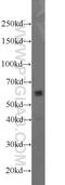 UDP Glycosyltransferase 8 antibody, 17982-1-AP, Proteintech Group, Western Blot image 