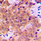 p65 antibody, LS-C352783, Lifespan Biosciences, Immunohistochemistry paraffin image 