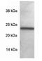 Synaptosomal-associated protein 23 antibody, GTX23340, GeneTex, Western Blot image 