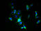 Zinc Finger DHHC-Type Containing 6 antibody, A61886-100, Epigentek, Immunofluorescence image 