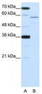 RNA-binding protein Nova-2 antibody, TA345801, Origene, Western Blot image 