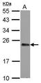 Glucosamine-Phosphate N-Acetyltransferase 1 antibody, GTX122246, GeneTex, Western Blot image 