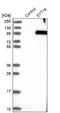 Synaptotagmin 16 antibody, NBP1-85628, Novus Biologicals, Western Blot image 