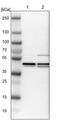 Zinc Finger And BTB Domain Containing 24 antibody, PA5-53340, Invitrogen Antibodies, Western Blot image 