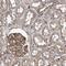 R-Spondin 3 antibody, PA5-56307, Invitrogen Antibodies, Immunohistochemistry paraffin image 