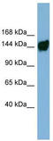 Aminoadipate-Semialdehyde Dehydrogenase antibody, TA337591, Origene, Western Blot image 