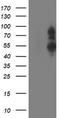 PHD Finger Protein 21B antibody, TA503205S, Origene, Western Blot image 