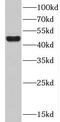 C-X-C Motif Chemokine Receptor 2 antibody, FNab02100, FineTest, Western Blot image 