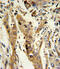 Glutathione S-Transferase Mu 1 antibody, A00569, Boster Biological Technology, Immunohistochemistry paraffin image 