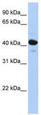 Corticosteroid 11-beta-dehydrogenase isozyme 2 antibody, TA346028, Origene, Western Blot image 
