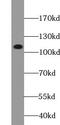 Ubiquitin carboxyl-terminal hydrolase 37 antibody, FNab09330, FineTest, Western Blot image 