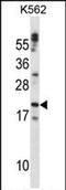Cardiotrophin-1 antibody, PA5-71926, Invitrogen Antibodies, Western Blot image 