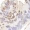 RecQ Mediated Genome Instability 1 antibody, A300-631A, Bethyl Labs, Immunohistochemistry paraffin image 
