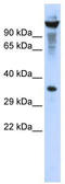 Ribonuclease T2 antibody, TA332101, Origene, Western Blot image 